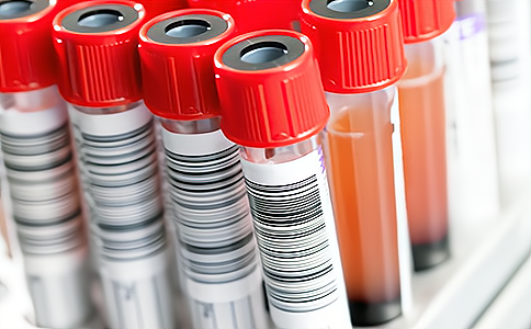 RFID系統(tǒng)在血液采集存儲(chǔ)與運(yùn)輸中的應(yīng)用